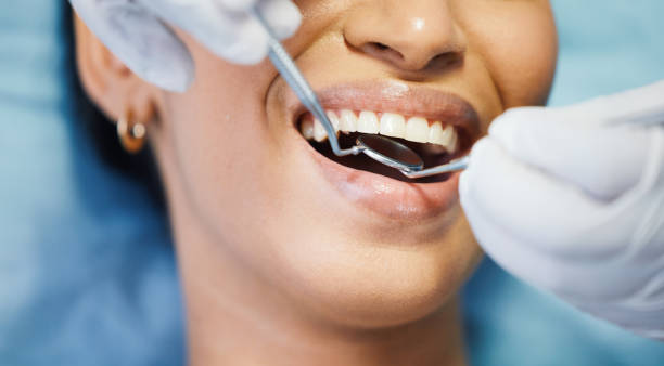 Best Lost Filling or Crown Replacement in Thorofare, NJ